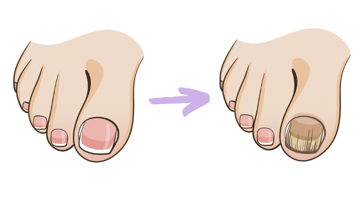 NailScience Antifungal Pen