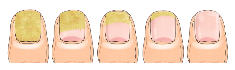 Foot care illustration